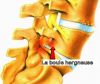 boule_986.jpg